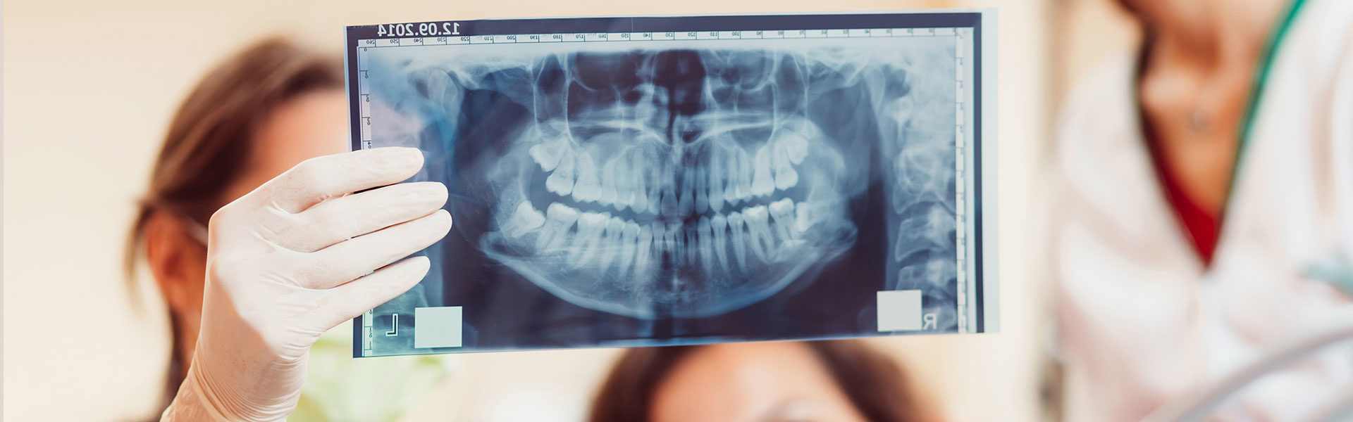 Digital X-Rays